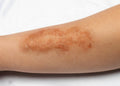 Impact FX Collection ~Aged Heat Trauma Mould Bundle