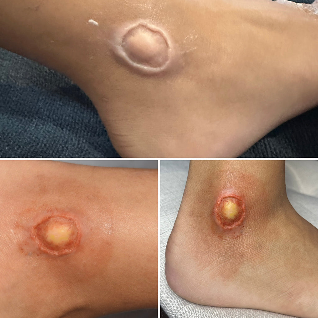 The Impact FX Collection ~ Ulcers Bundle