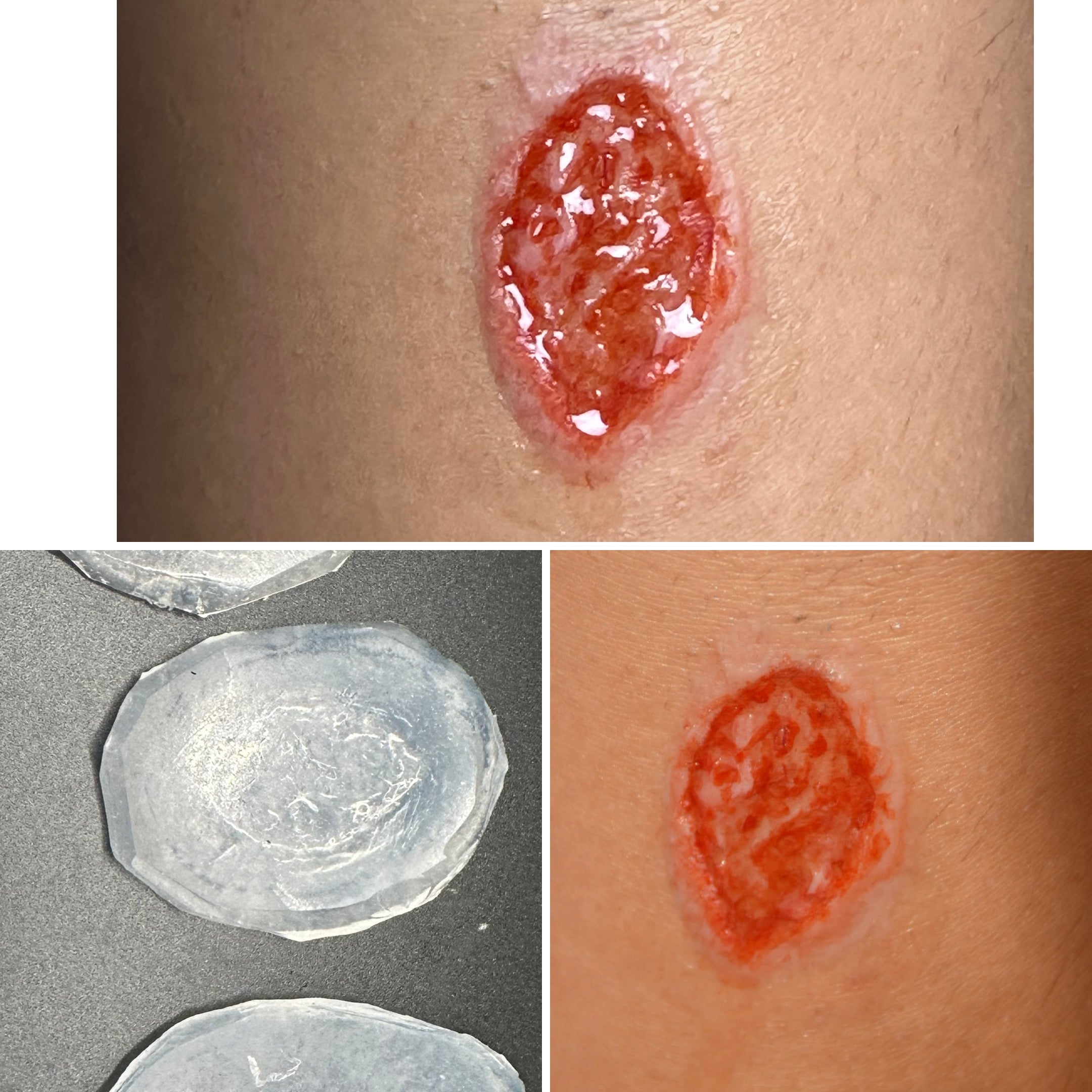 The Impact FX Collection ~ Ulcers Bundle