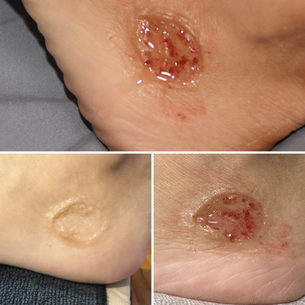 The Impact FX Collection ~ Ulcers Bundle