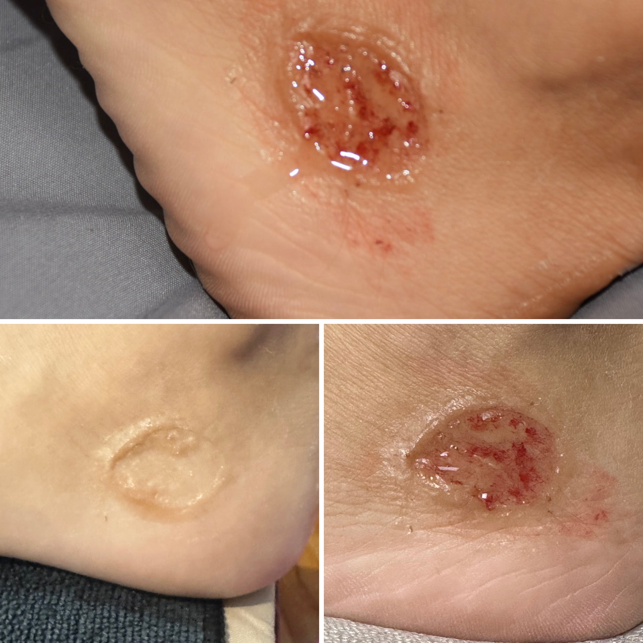 The Impact FX Collection ~ Ulcers Bundle