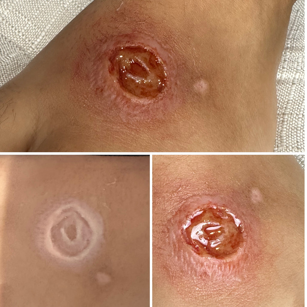 The Impact FX Collection ~ Ulcers Bundle