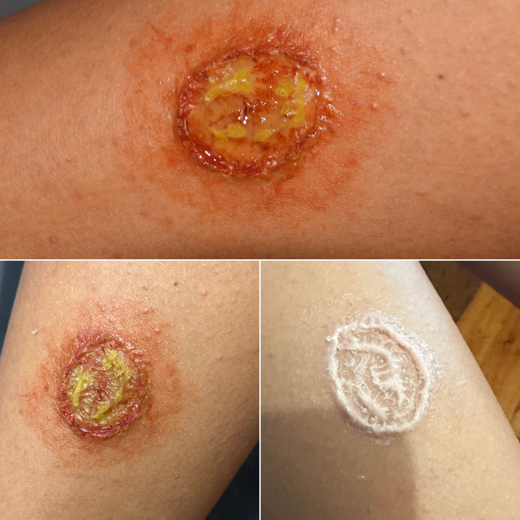 The Impact FX Collection ~ Ulcers Bundle