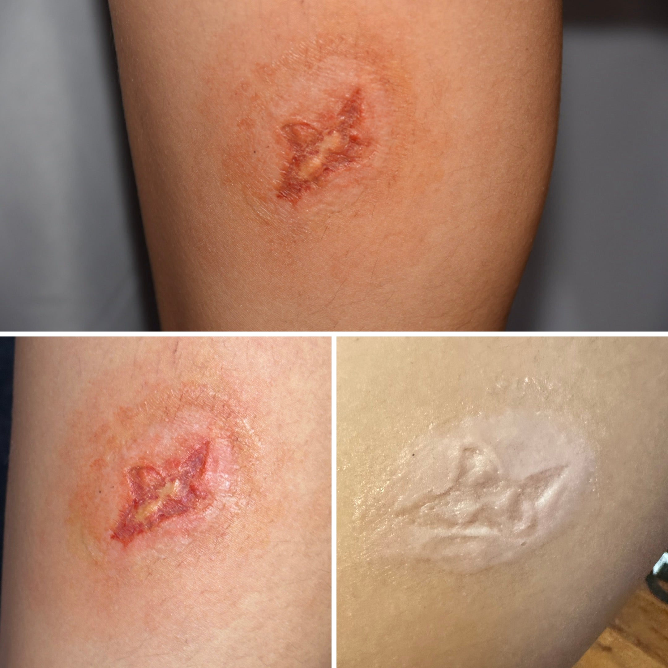 The Impact FX Collection ~ Ulcers Bundle