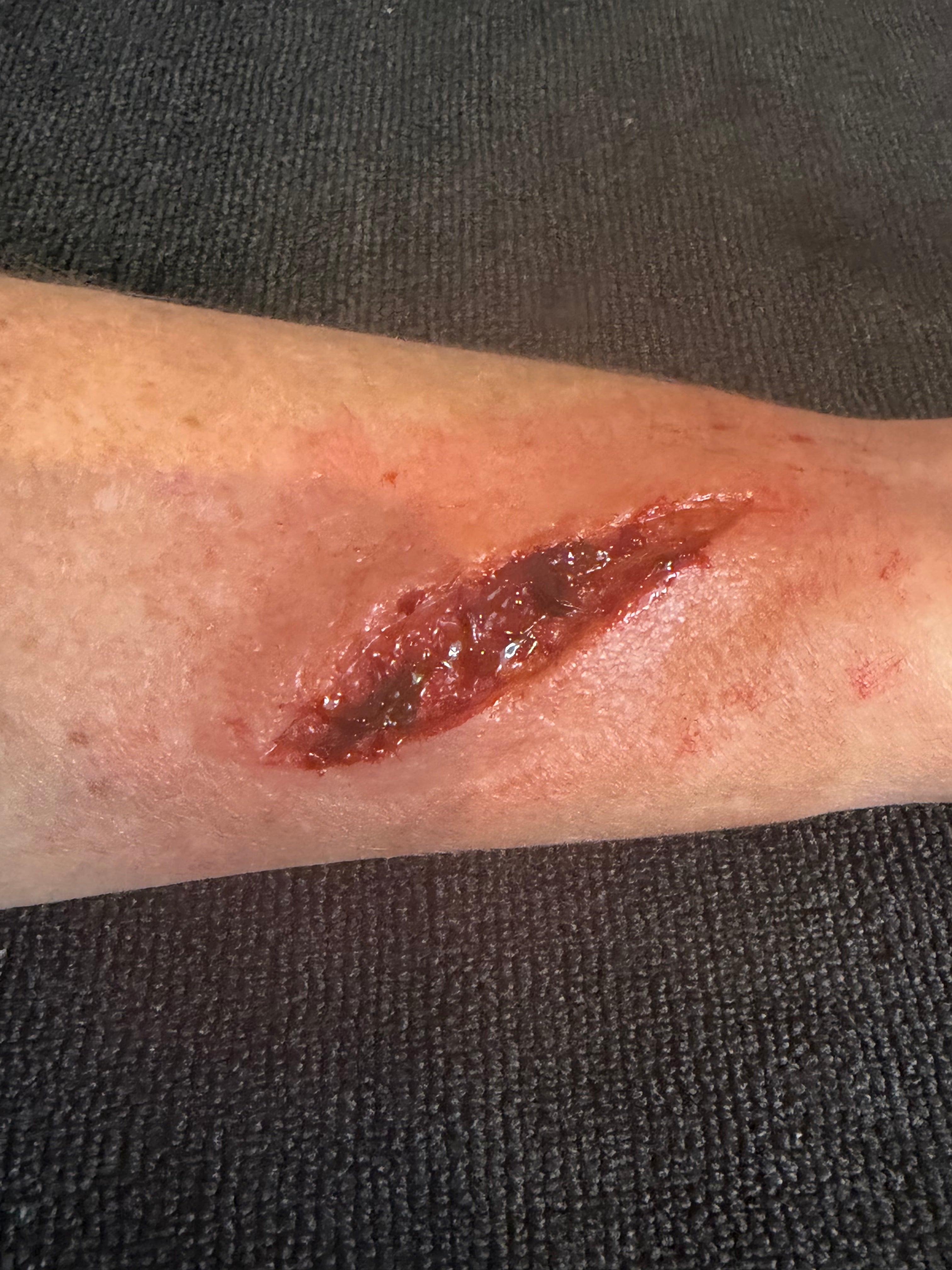 CUT Series - Deep Fleshy